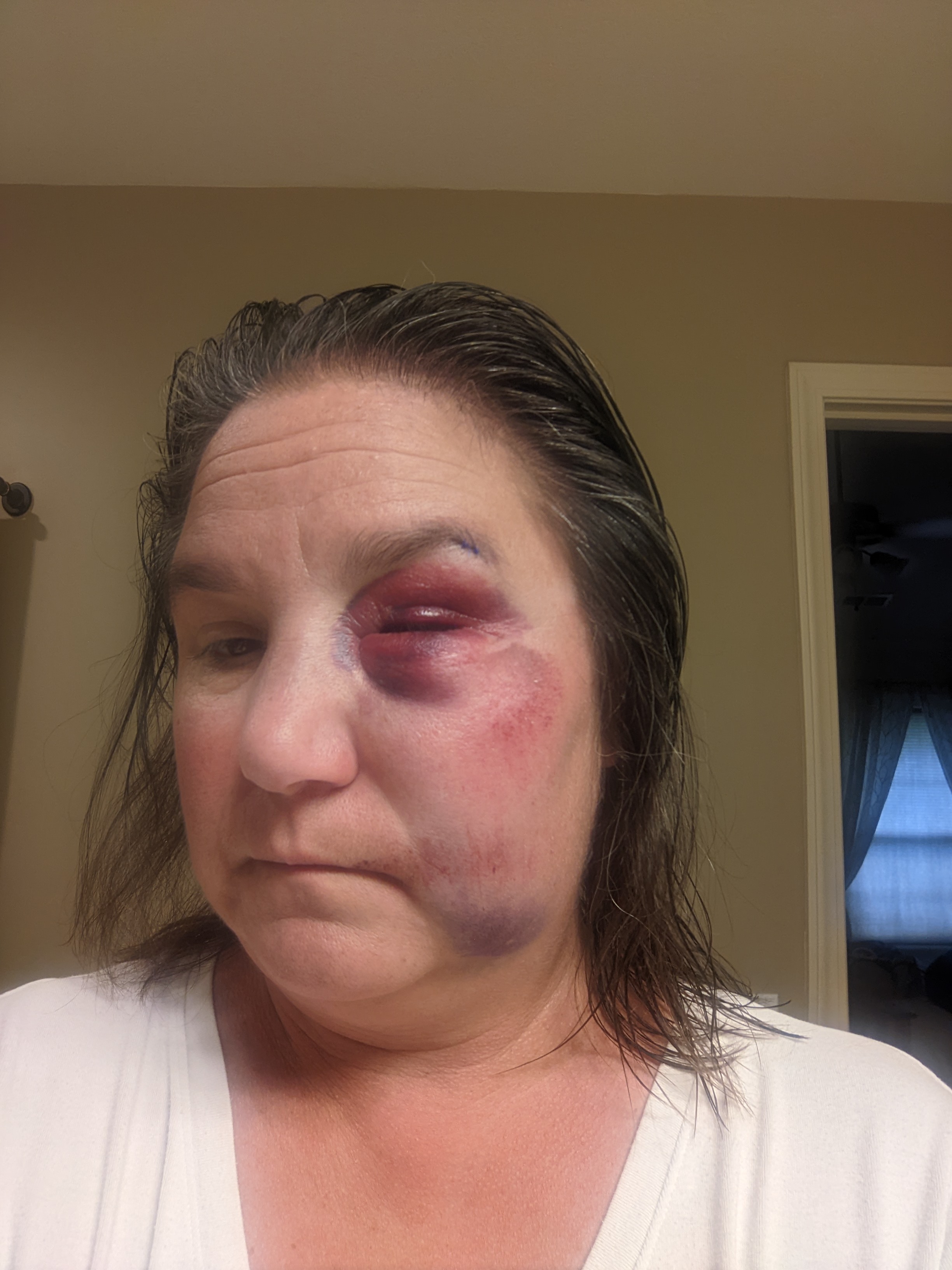 Day2PXL 20220917 190700810