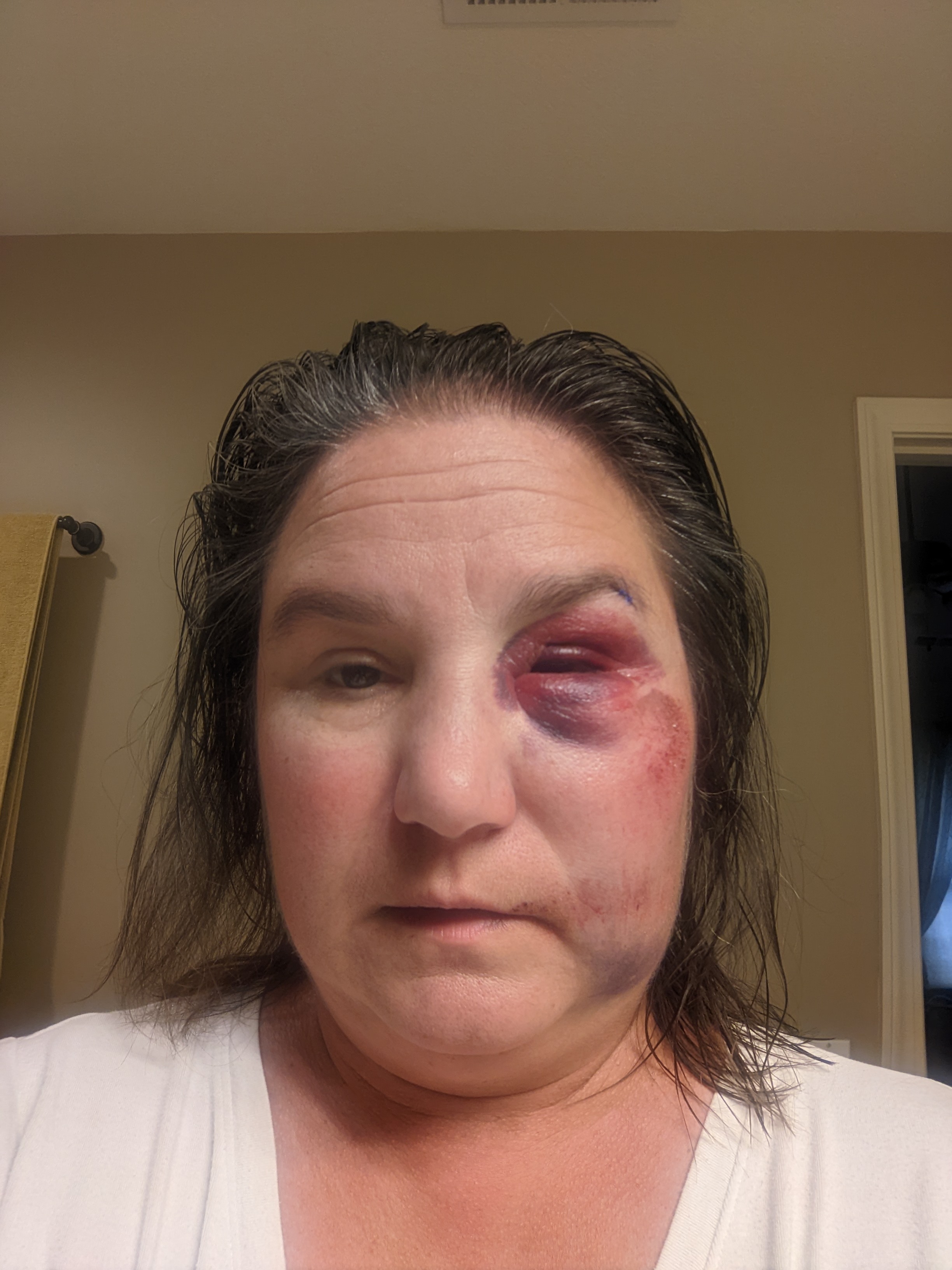 Day2PXL 20220917 190702755