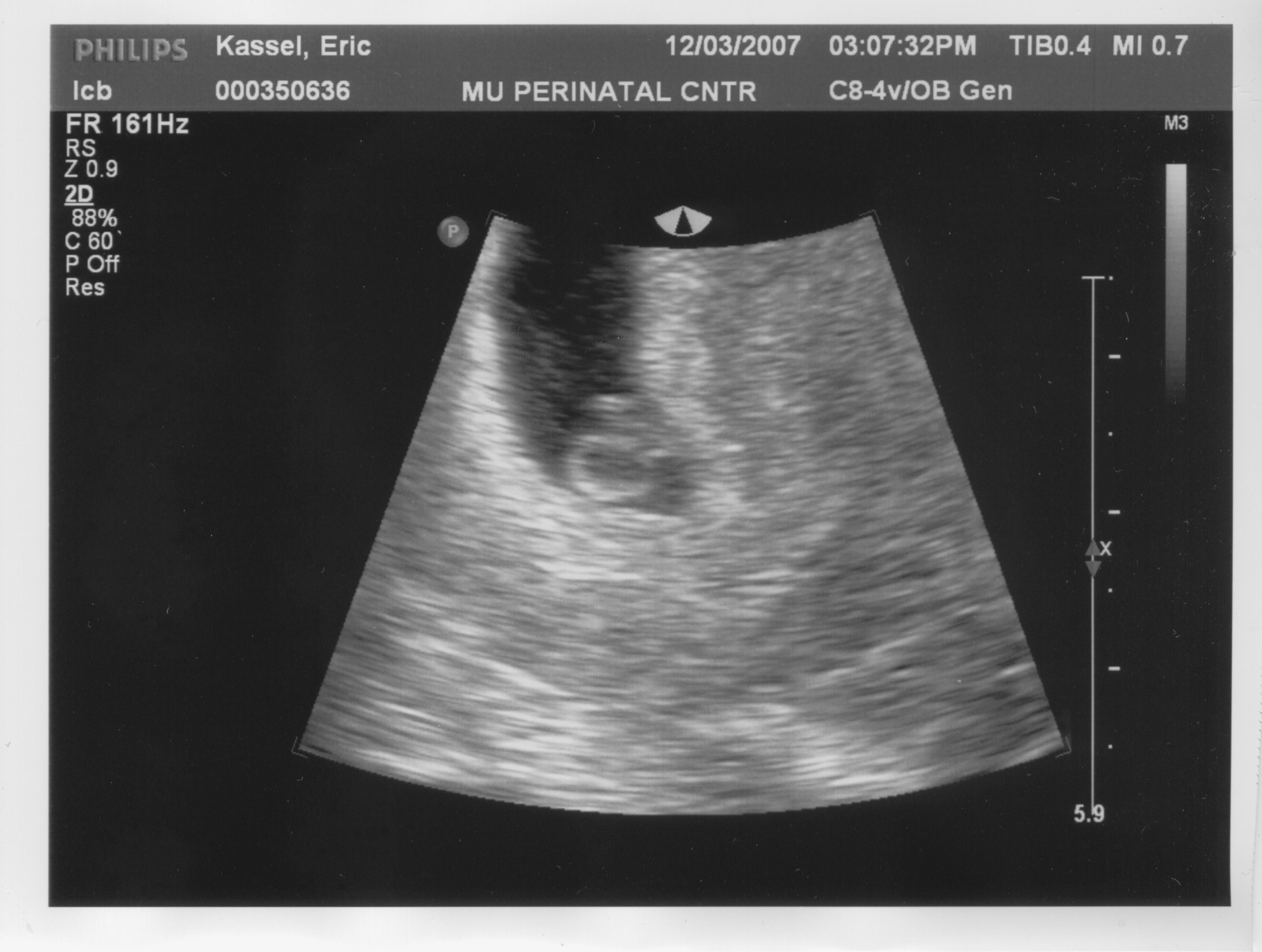 Sonogram2