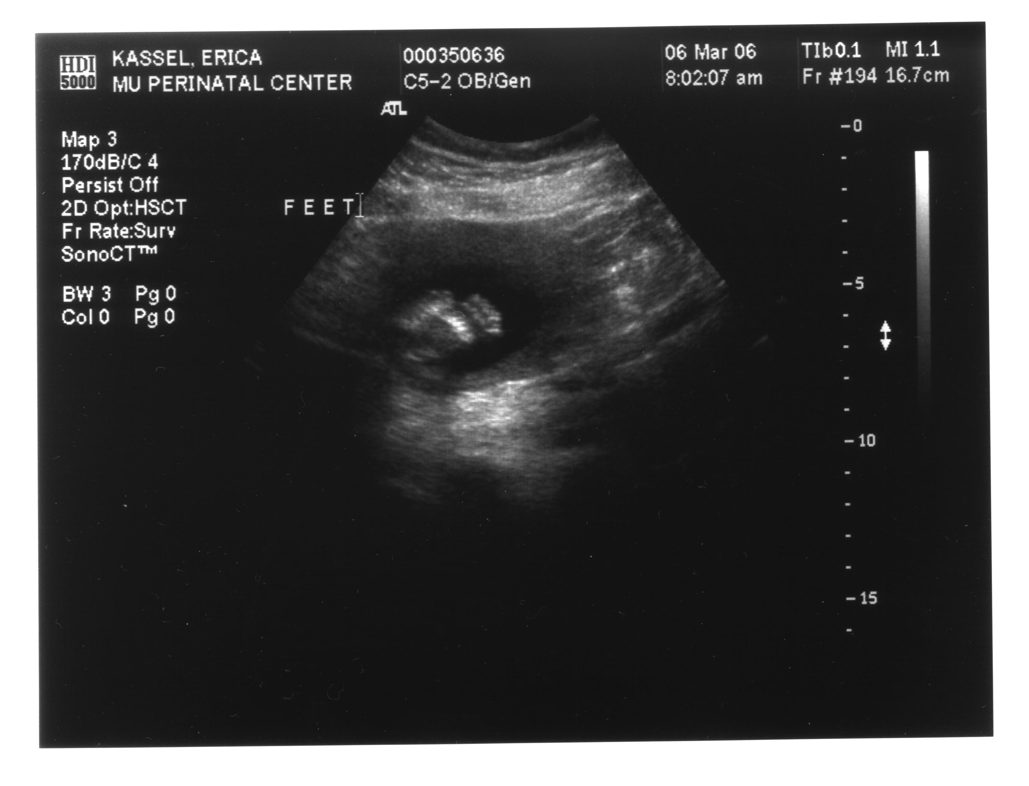 First Ultrasound