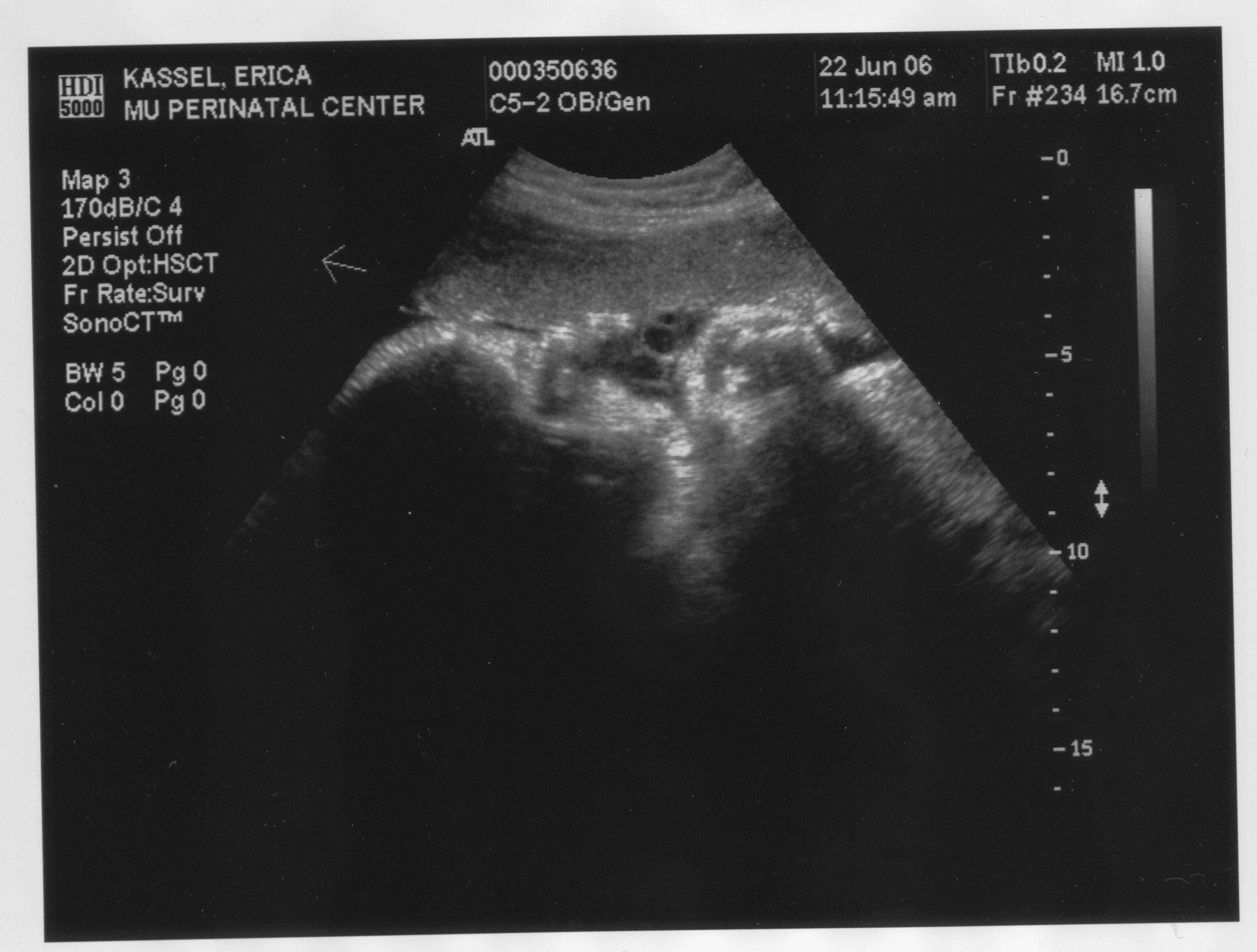Ultrasound2 6