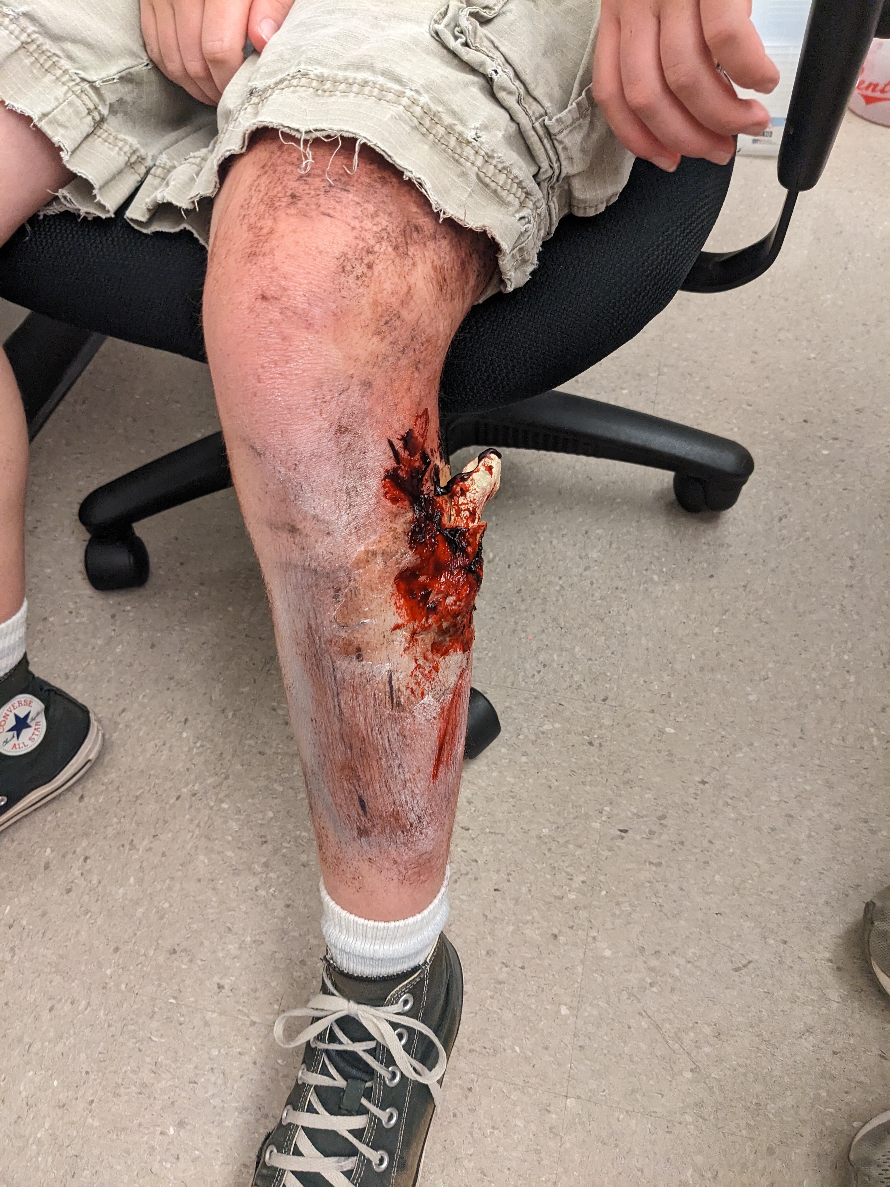 PXL 20230607 194900591